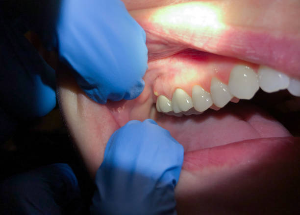 Best Root Canal Emergency Dentist  in Forest Park, IL